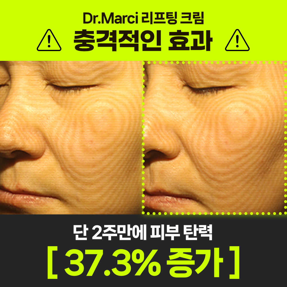 닥터마르시 이노프팅크림 탄력 37% 콜라겐 리프팅 세라마이드 덱스판테놀 30ml, 1개 이미지 3