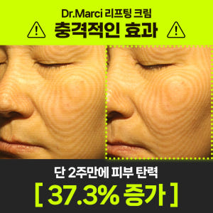 닥터마르시 이노프팅크림 탄력 37% 콜라겐 리프팅 세라마이드 덱스판테놀 ... 솔직 후기 | 피부 타입별 분석 - 상품 이미지 3