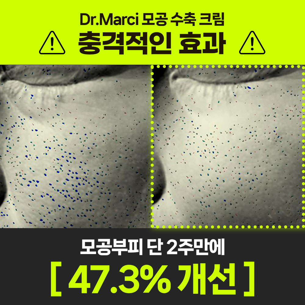 닥터마르시 피지 조절 크림 모공수축 54% 블랙헤드 나비존 오돌토돌 요철 1개입, 1개 이미지 2