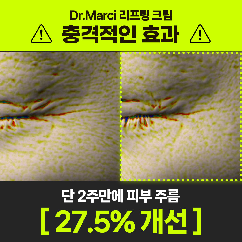 닥터마르시 이노프팅크림 탄력 37% 콜라겐 리프팅 세라마이드 덱스판테놀 30ml, 1개 이미지 2