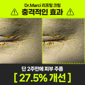 닥터마르시 이노프팅크림 탄력 37% 콜라겐 리프팅 세라마이드 덱스판테놀 ... 솔직 후기 | 피부 타입별 분석 - 상품 이미지 2