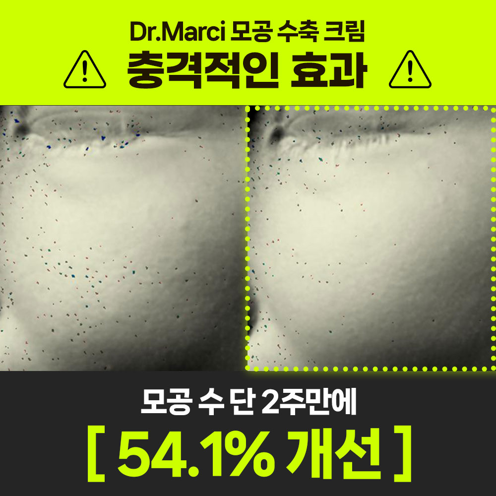 닥터마르시 피지 조절 크림 모공수축 54% 블랙헤드 나비존 오돌토돌 요철 1개입, 1개 이미지 3
