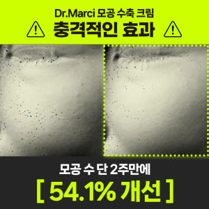 닥터마르시 피지 조절 크림 모공수축 54% 블랙헤드 나비존 오돌토돌 요철... 솔직 후기 | 피부 타입별 분석 - 상품 이미지 3