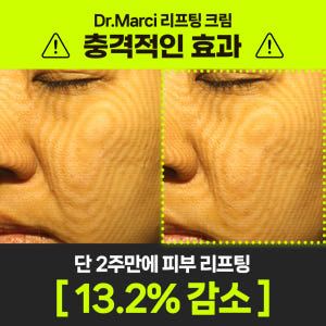 닥터마르시 이노프팅크림 탄력 37% 콜라겐 리프팅 세라마이드 덱스판테놀 ... 솔직 후기 | 피부 타입별 분석 - 상품 이미지 4