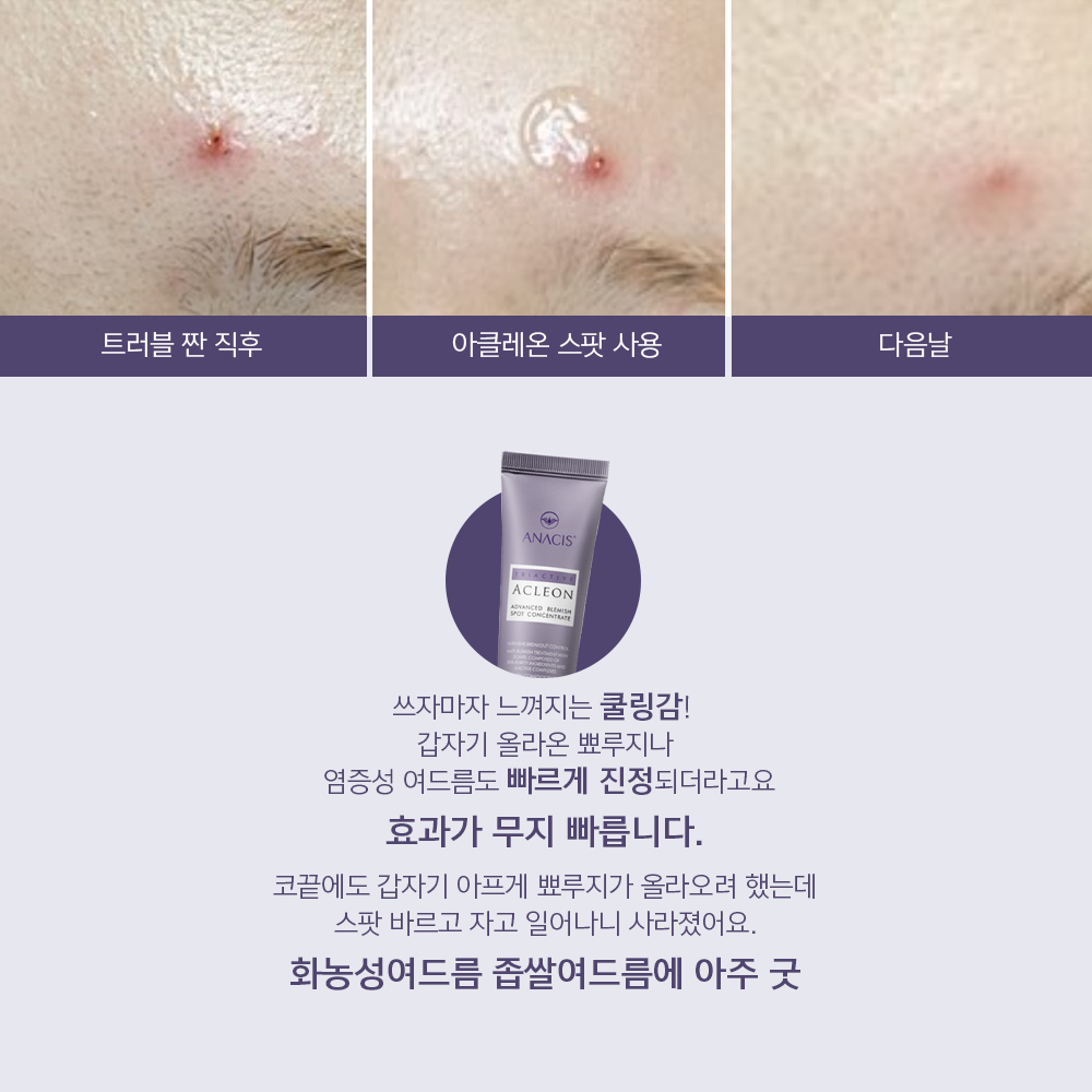 아클레온 센텔라드레싱파우더 티트리 염증 여드름 스팟 젤 30ml 여드름 빨간 붉은 자국 이미지 7