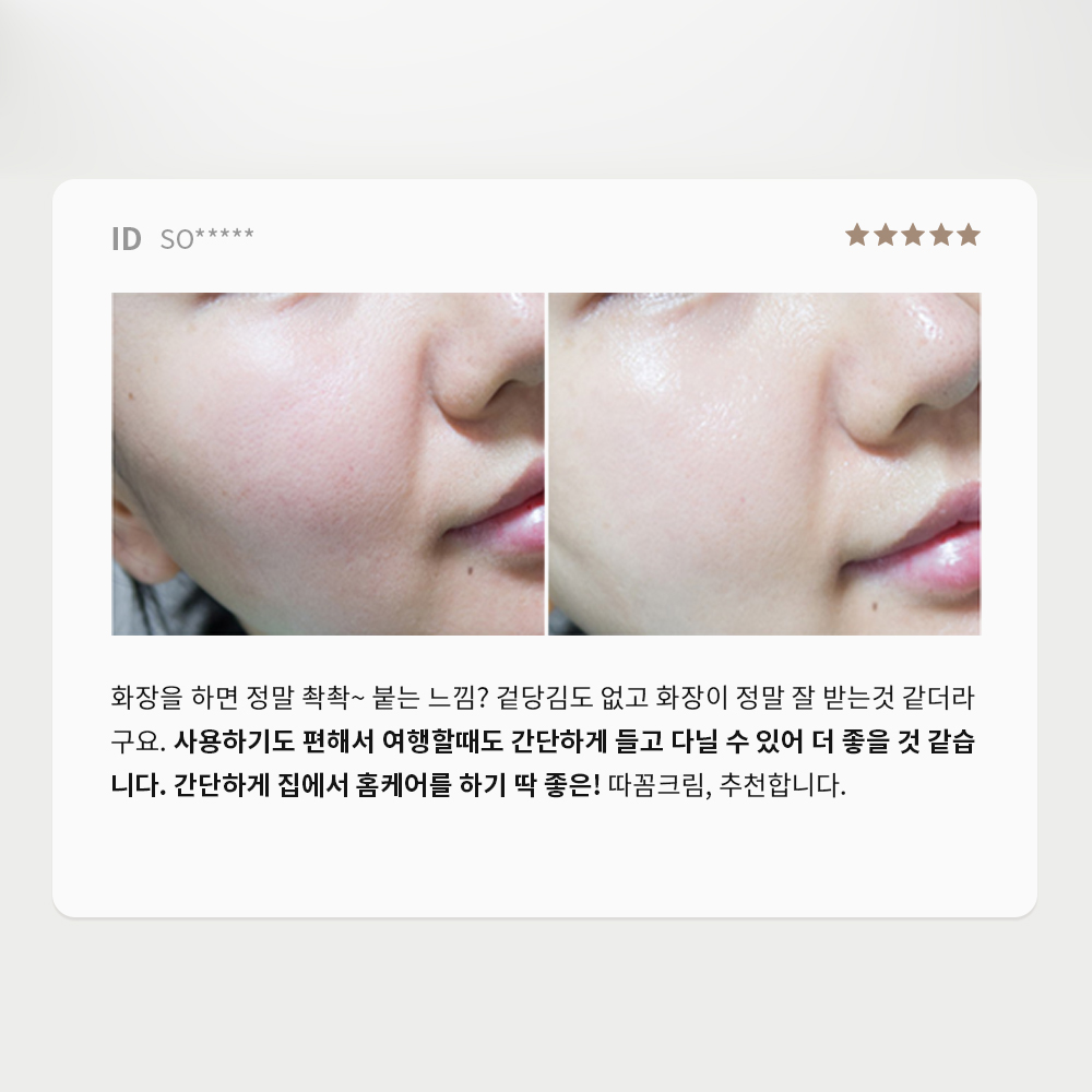 셀포메드 스피큘 엑스 폴리앙뜨 크림 따꼼크림 50ml - 상세 이미지 4
