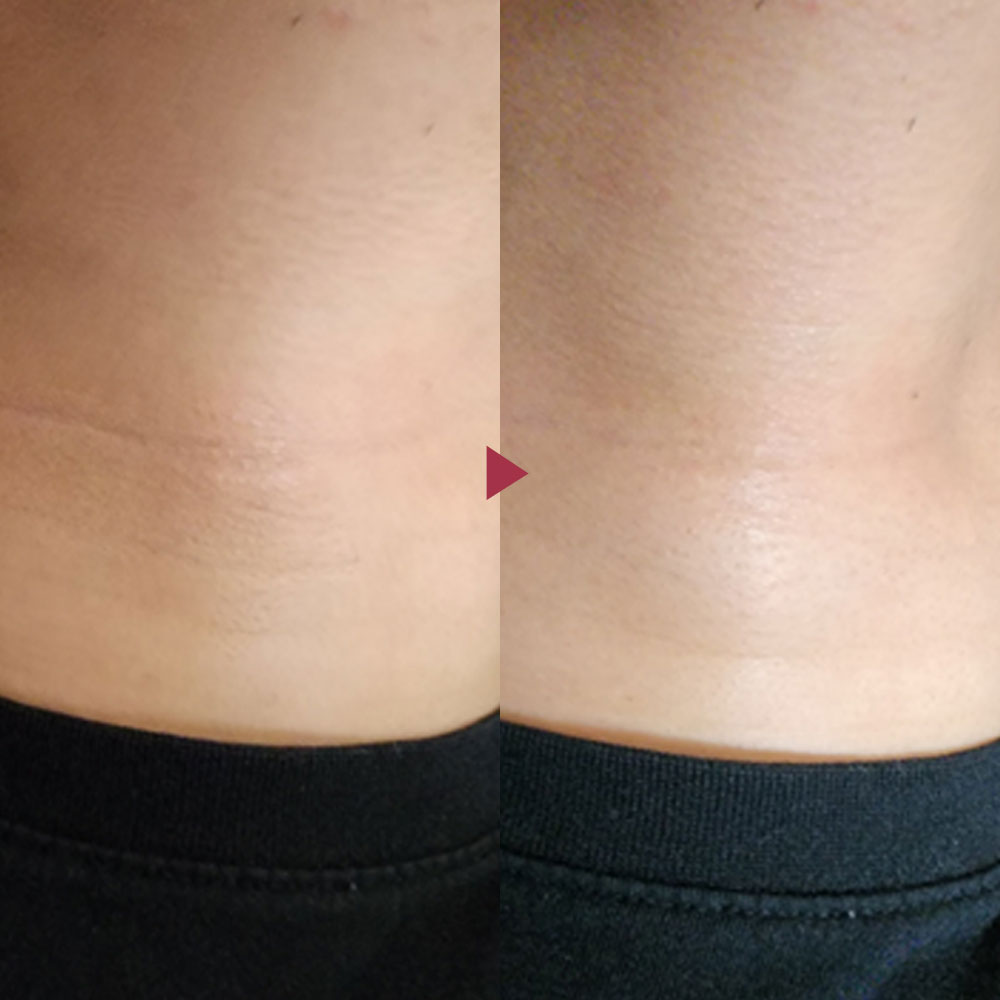 벨라컨투어 퍼밍 바르는 콜라겐 볼꺼짐 이마주름 팔자주름 목주름 동안 크림 30ml - 상세 이미지 4