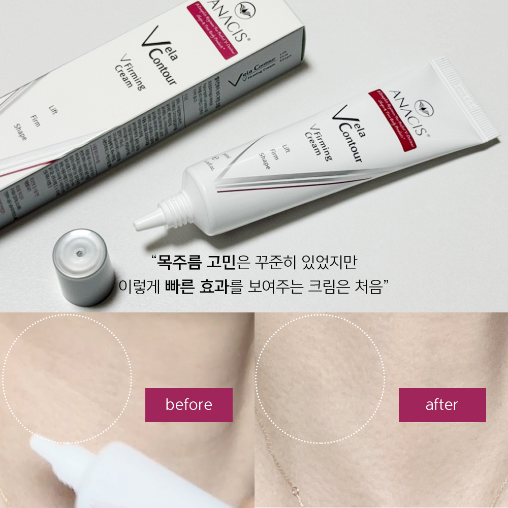 벨라컨투어 퍼밍 바르는 콜라겐 볼꺼짐 이마주름 팔자주름 목주름 동안 크림 30ml - 상세 이미지 5