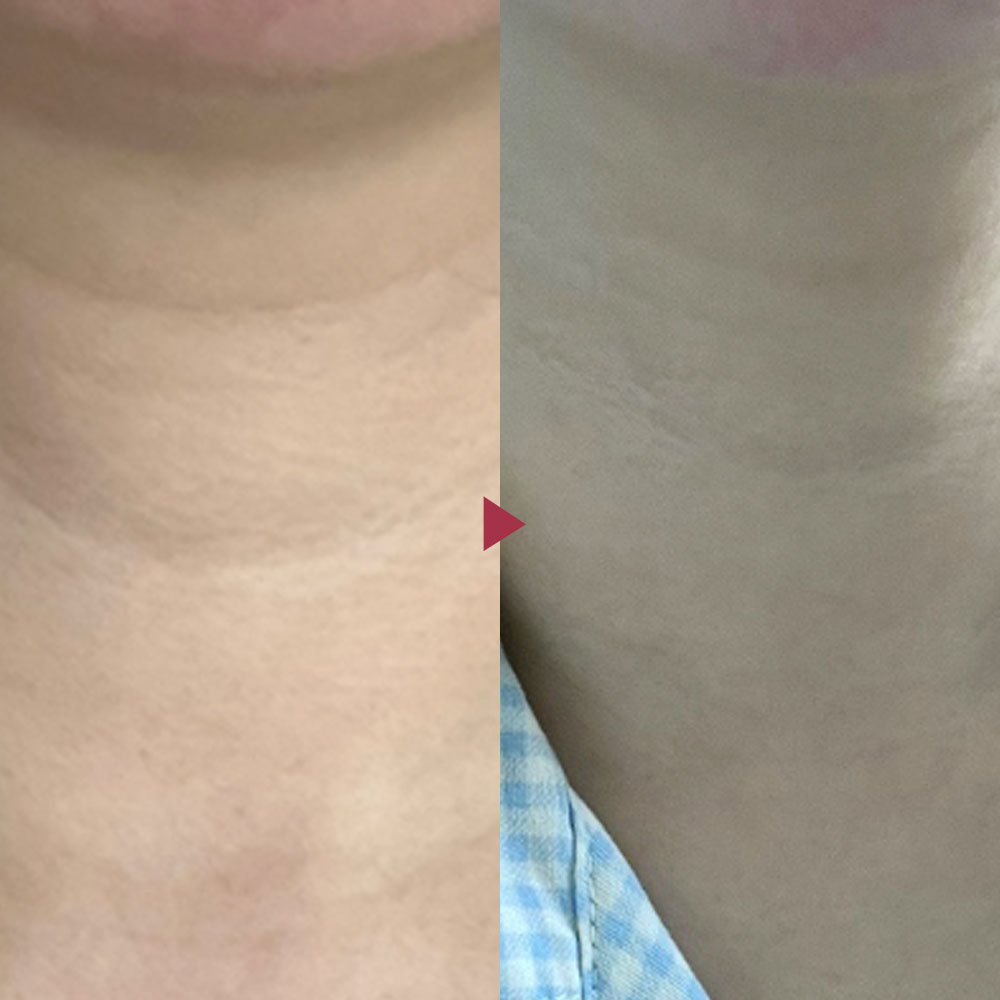 벨라컨투어 퍼밍 바르는 콜라겐 주름개선 크림 30ml - 상세 이미지 5