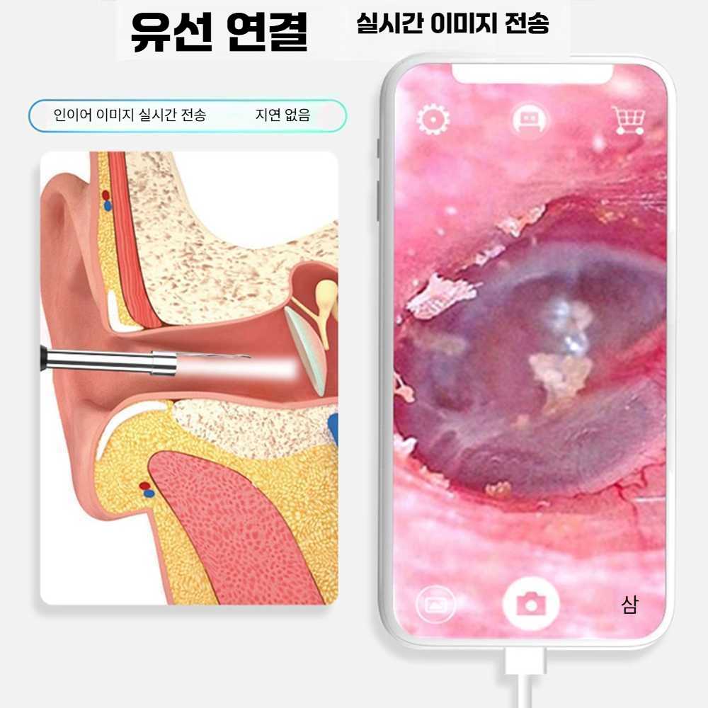 고스트캠프 귀내시경 귀청소 스마트 귀이개 귀지제거 안드로이드 5.5mm 200만 - 상세 이미지 3