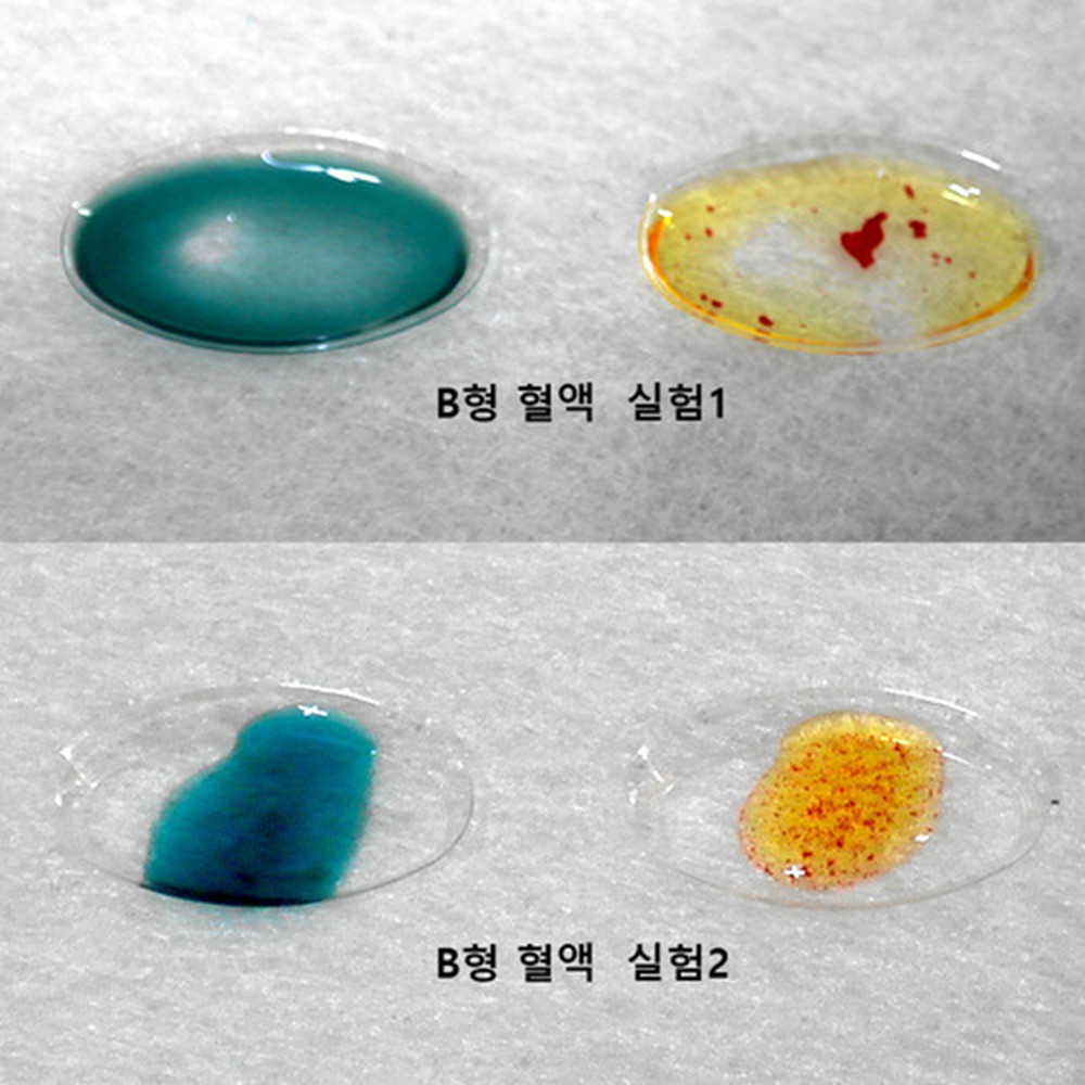 5인용 중학생 생명과학 혈액형 검사키트 혈액판정 응집 실험학습 방과후 체험용 : 자유나래 스토어