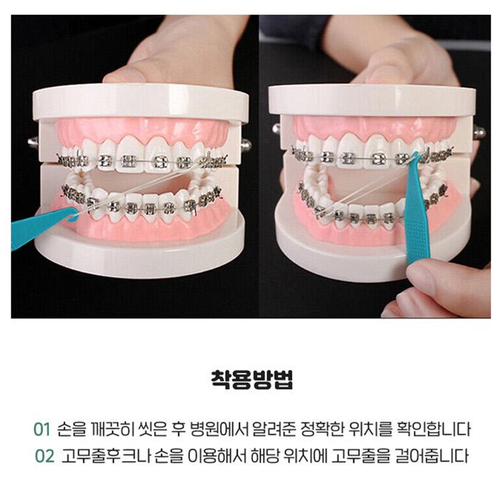 교정기고무줄 치아교정고무줄 이빨셀프교정 100개 이미지 8