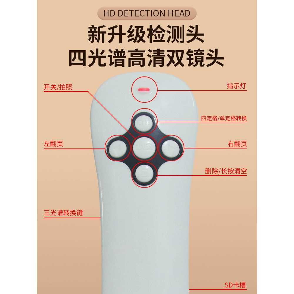 두피 확대경 디지털 현미경 카메라 모발 피부 검사기 플러그인 - 상세 이미지 3