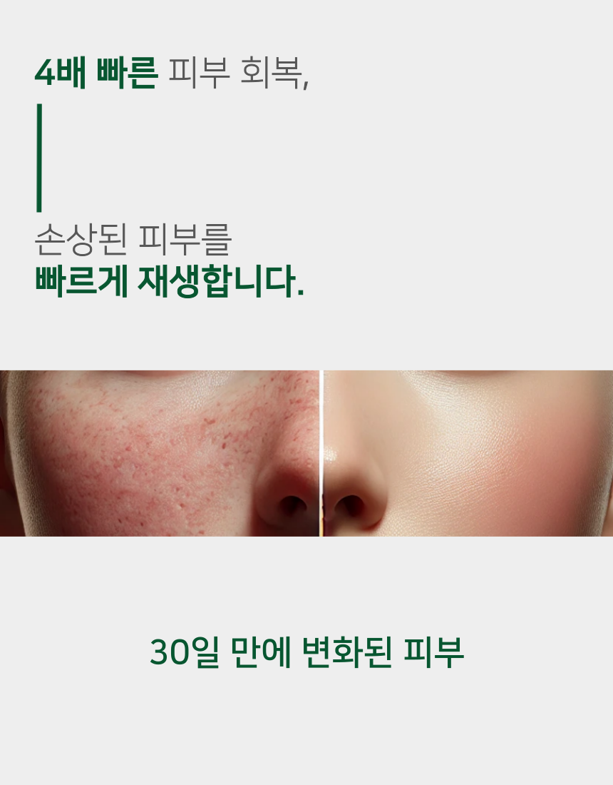 프랑스산 시카앤 재생 크림 피부과 레이저 점빼고 점뺀 후 기미 시카 20 50ml, 1개 이미지 6