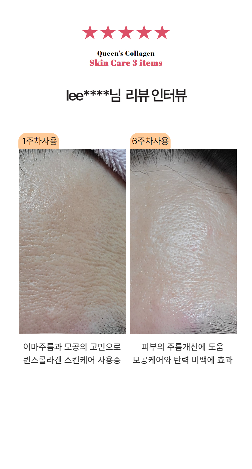 퀸스 세라마이드 크림 피부 장벽 수분 앰플 수분 보습 히알루론산 비타민 세럼 속건조 탄력 - 상세 이미지 4