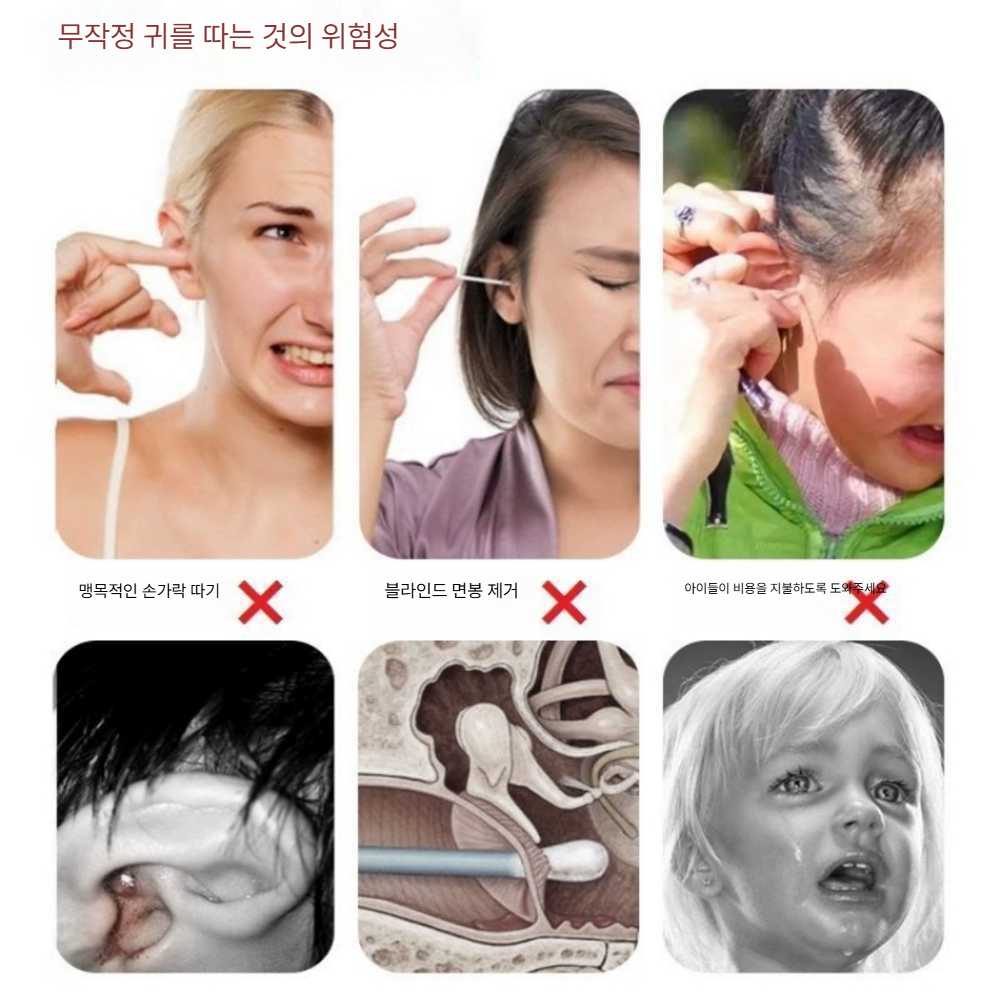 고스트캠프 귀내시경 귀지제거 귀 귀이개 귀파개 3.5mm 검정 500만 - 상세 이미지 3
