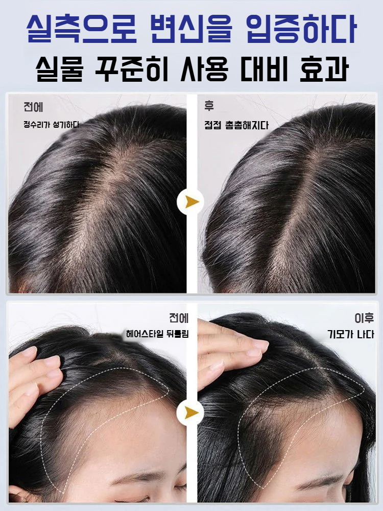 1+1 탈모 방지 모발 강화 롤러 헤어 에센스 : 뷰티 오아시스