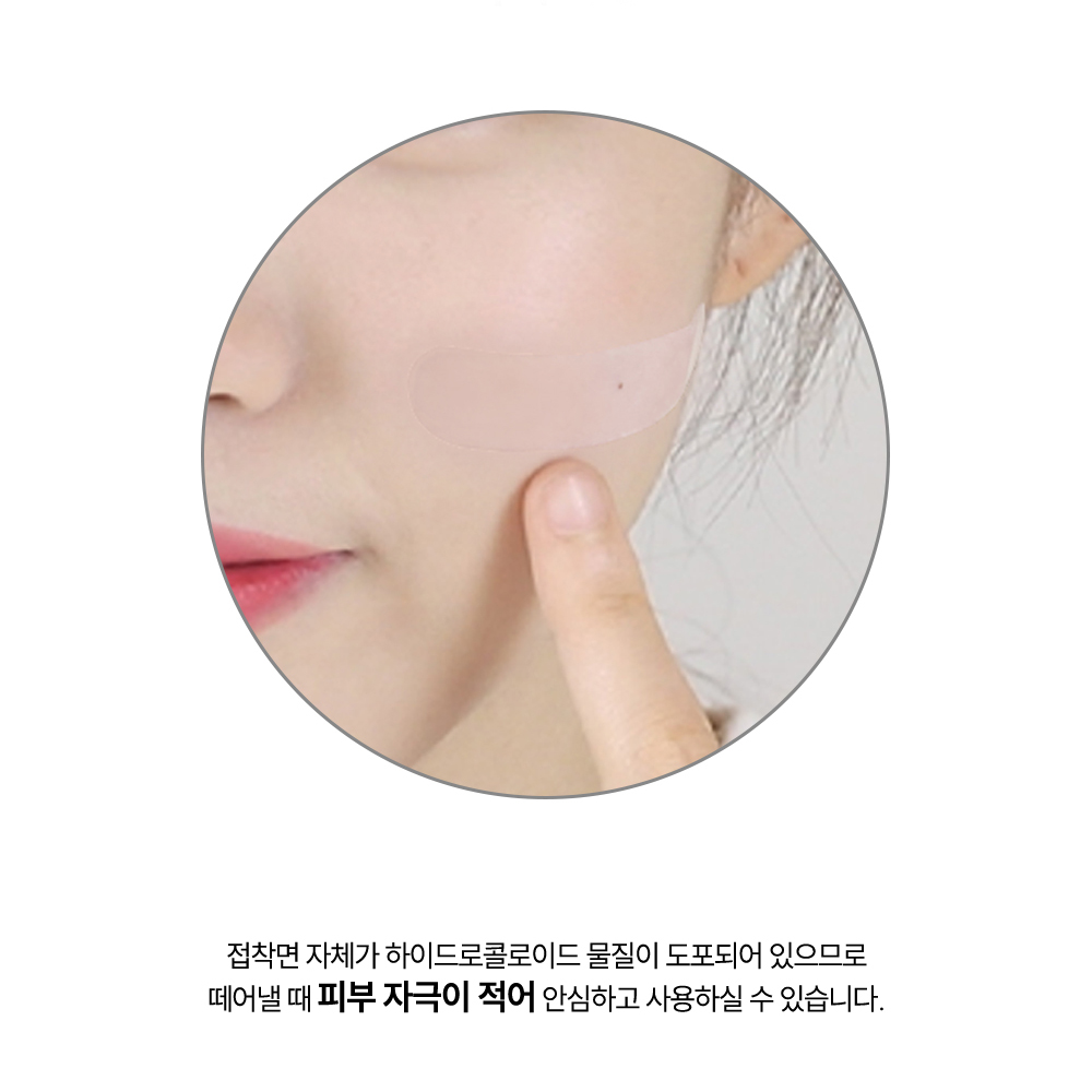 딤플밴드더블랙2개+더마라이프1개 상처보호 습윤 찰과상밴드 방수반창고 흉터연고 이미지 7