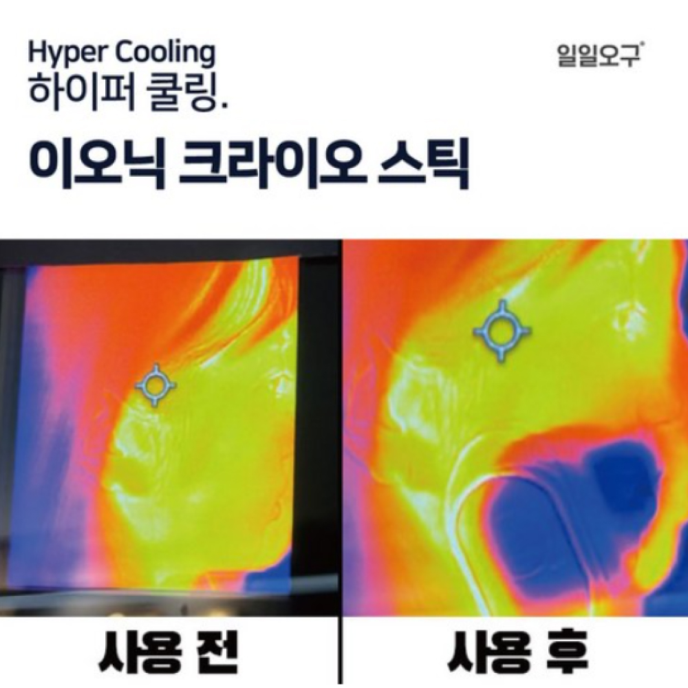 얼굴 붓기 쿨링 제품 아이스퀸 이오닉 크라이오 셀 사용후기