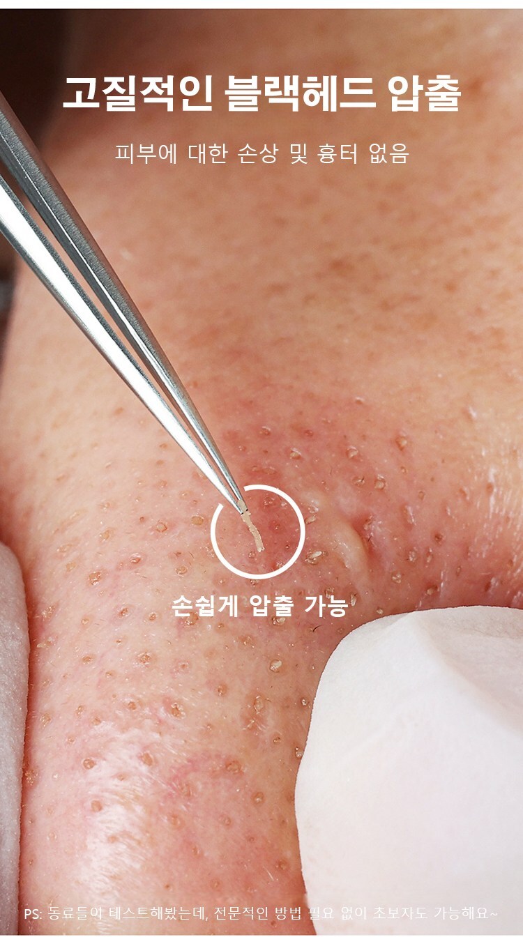 피지핀셋 블랙 핀셋여드름 핀셋0.01mm 정밀도 : 행복가