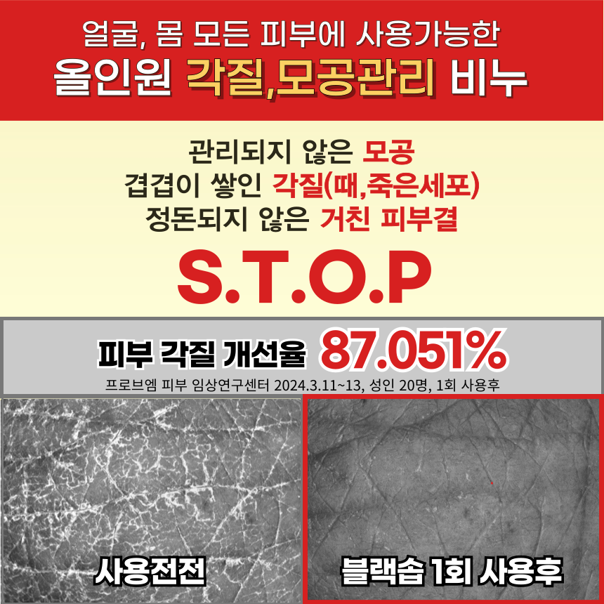 르세라이 마르세유 프랑스 올리브 비누 블랙솝 세트 - 상세 이미지 4