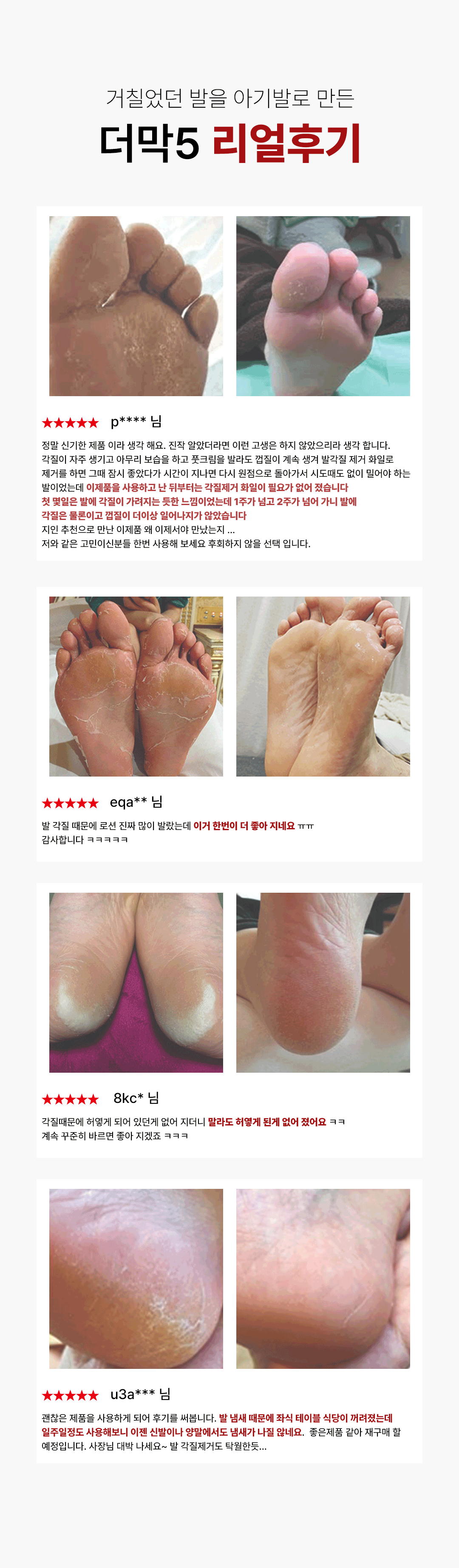 풋오일 막풋 각질제거 발 뒤꿈치 발바닥 굳은살 갈라짐 고운 각질연화제 풋크림 이미지 4