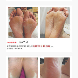 풋오일 막풋 각질제거 발 뒤꿈치 발바닥 굳은살 갈라짐 고운 각질연화제 풋... 솔직 후기 | 피부 타입별 분석 - 상품 이미지 4