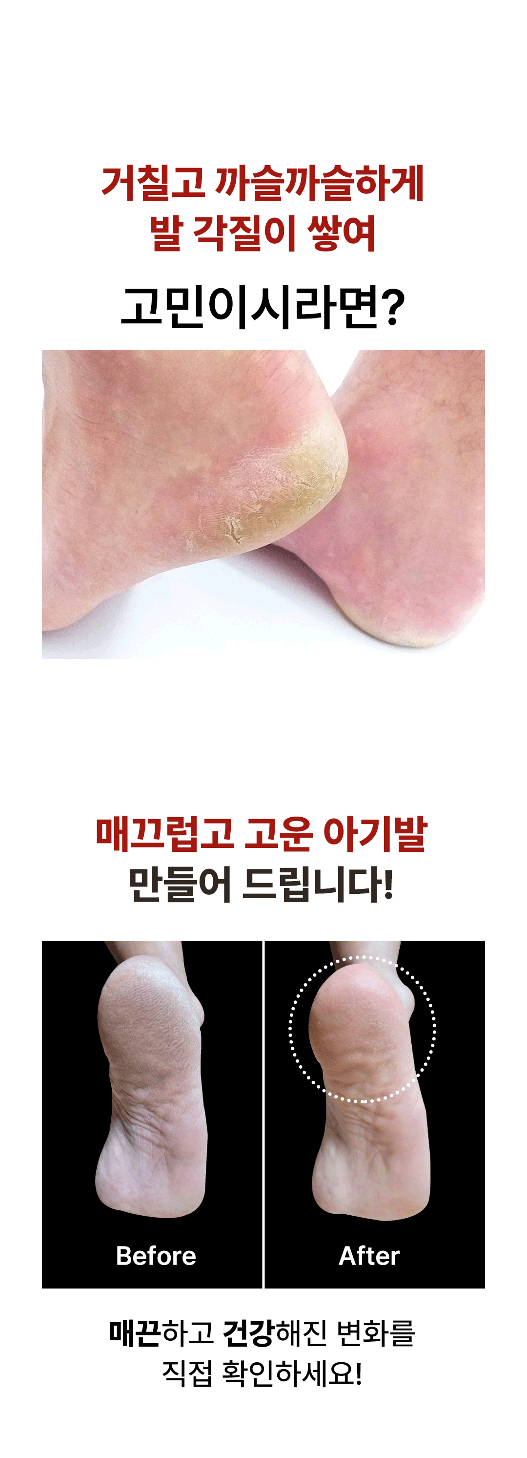 풋오일 막풋 각질제거 발 뒤꿈치 발바닥 굳은살 갈라짐 고운 각질연화제 풋크림 이미지 3