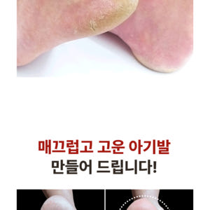 풋오일 막풋 각질제거 발 뒤꿈치 발바닥 굳은살 갈라짐 고운 각질연화제 풋... 솔직 후기 | 피부 타입별 분석 - 상품 이미지 3