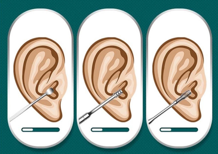10종 귀후비개 귀파개 세트 귀후비게 귀이개 청소 귀파기 휴대용 어린이 귀지 제거 나선형 - 상세 이미지 5