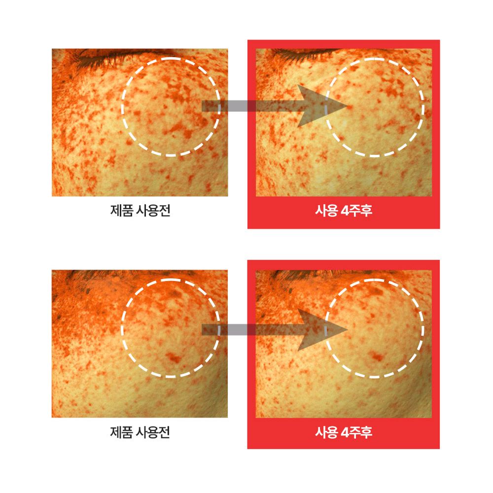 나이아신아마이드 미백세럼 기미잡티 앰플사용후기 피터앤랩스