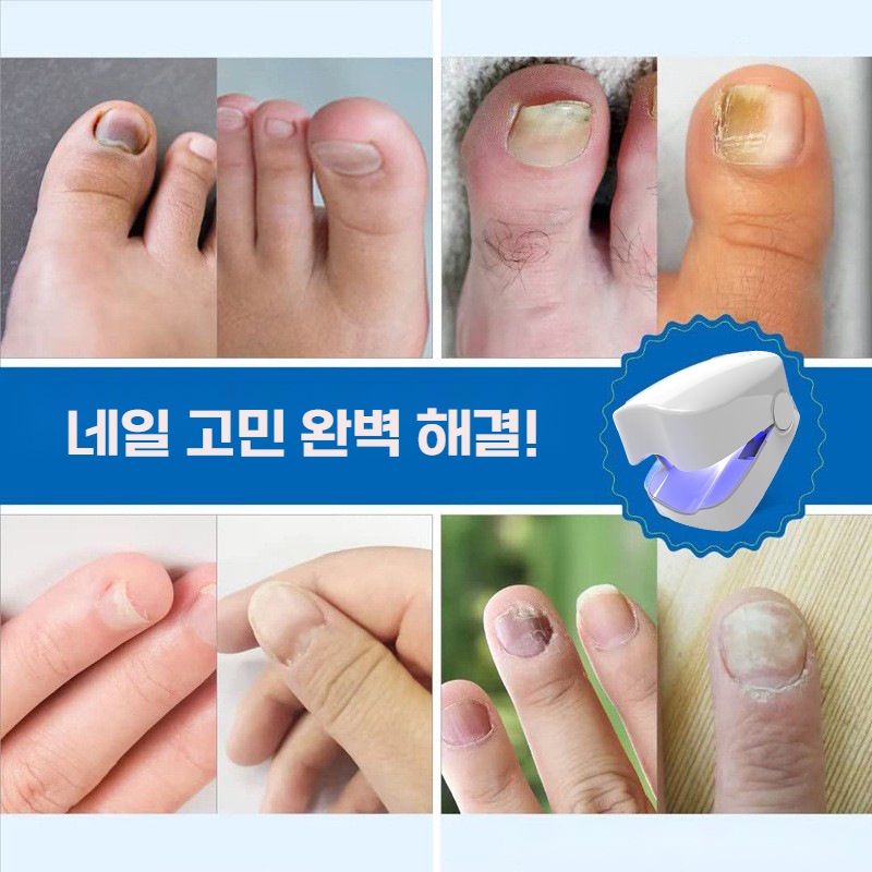 홈쇼핑 닥터레진 UV 발톱 손톱관리 손톱정리도구 네일케어도구 - 상세 이미지 2