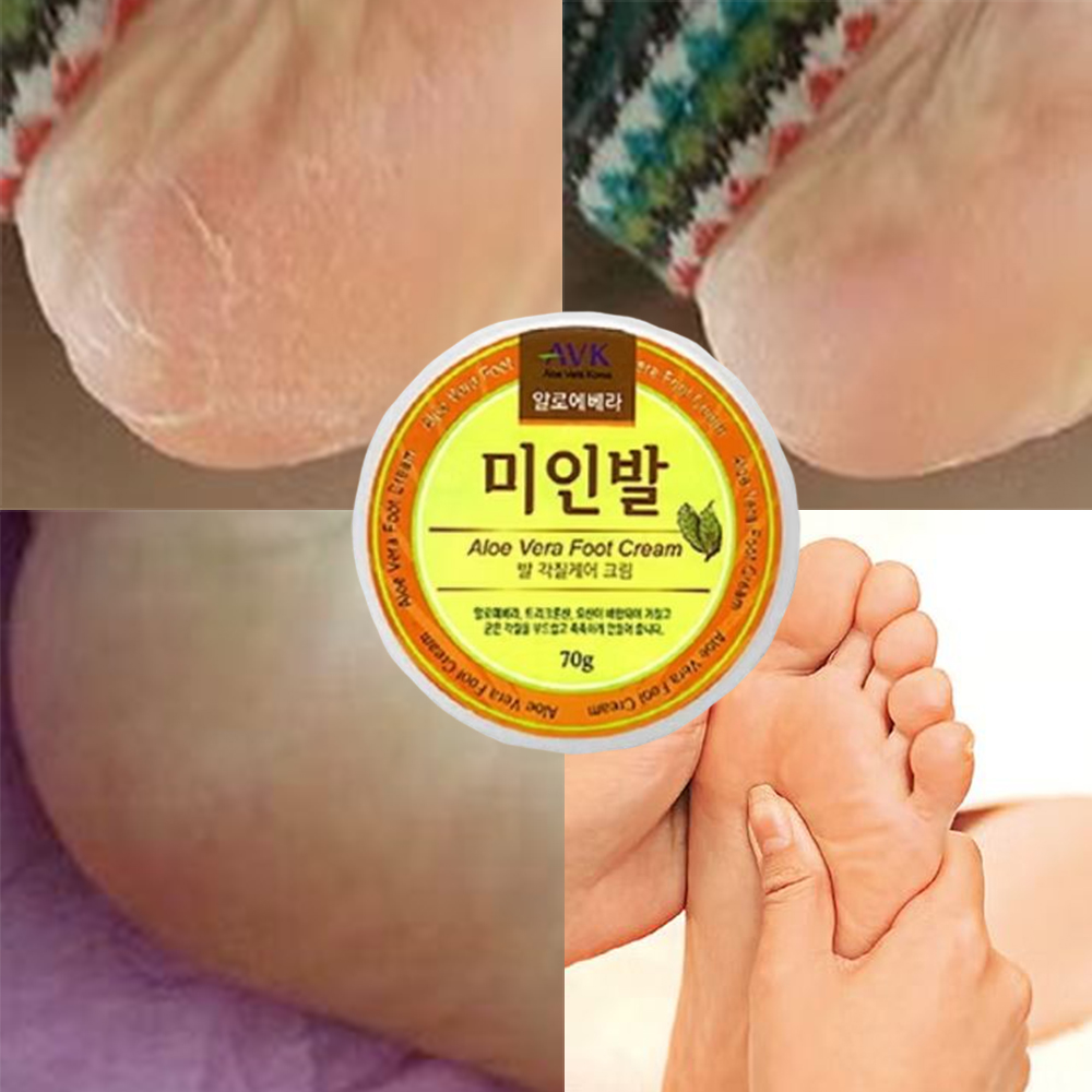 각질 케어 발크림 건조한발 영양 갈라진발 보습 발냄새 완화 - 상품 이미지