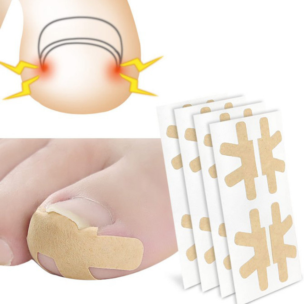 new발톱 테이프 4p엄지 발톱고정 테이프 밴드 스티커 파고드는