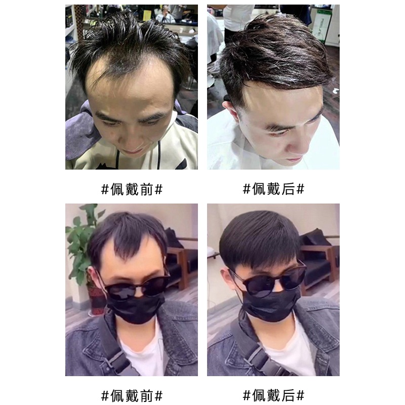 남성 스킨가발 앞머리 가발 붙이는 넓은이마 커버 - 상세 이미지 3