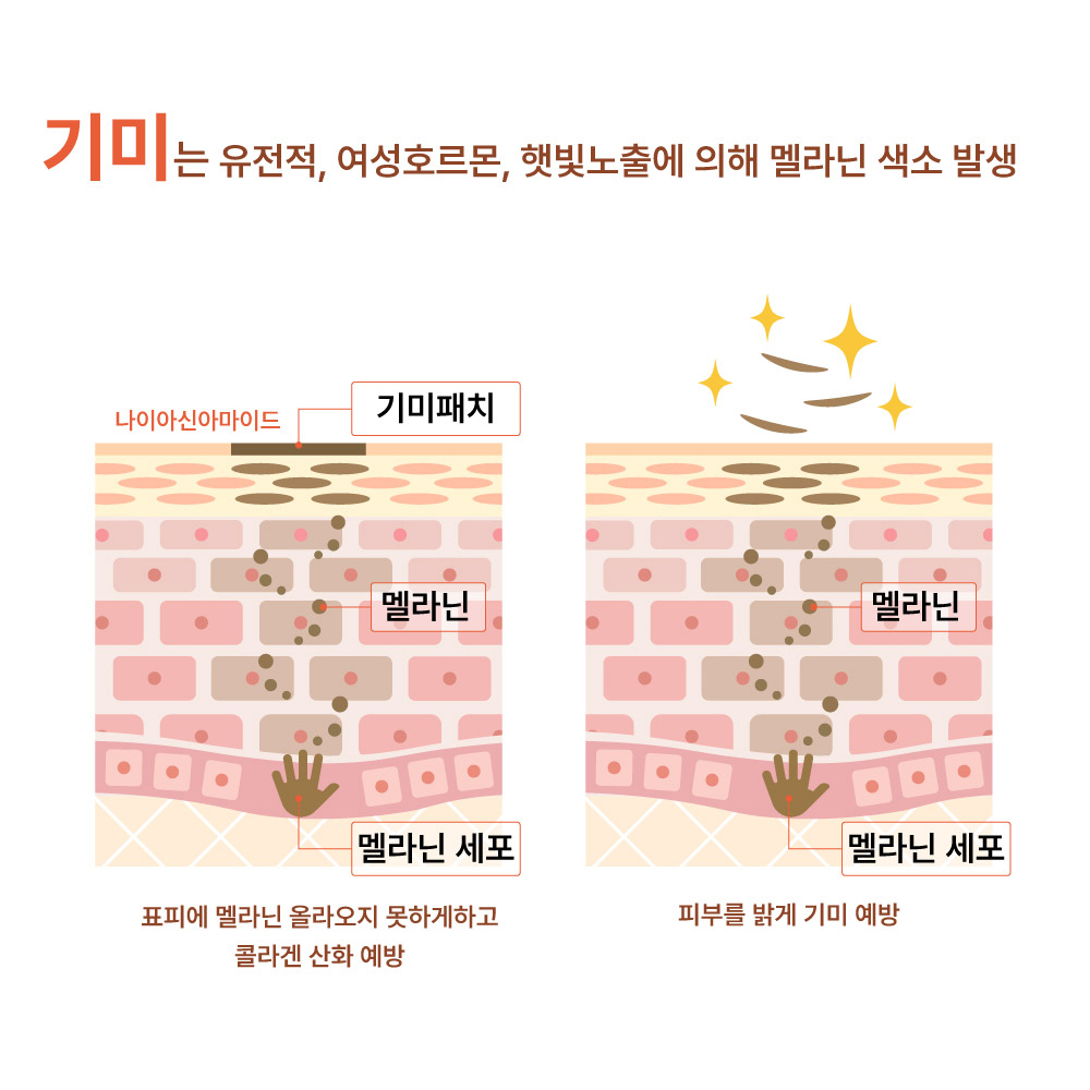 오즈케어 나이아신아마이드 1000ppm 기미 검버섯 잡티 지우개 패치 5세트 - 상세 이미지 5