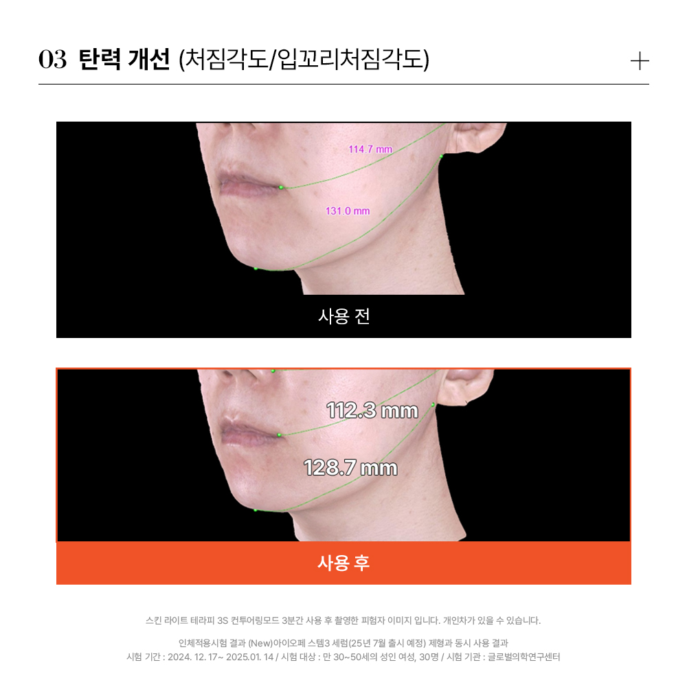 스킨 라이트 테라피 피부관리법 3초진단 피부관리 후기 꿀팁