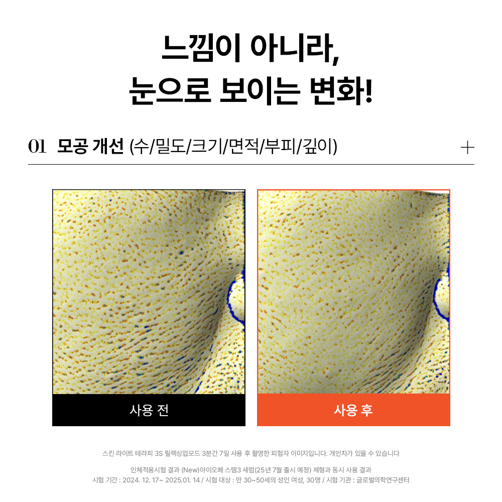 스킨 라이트 테라피 피부관리법 3초진단 피부관리 후기 꿀팁
