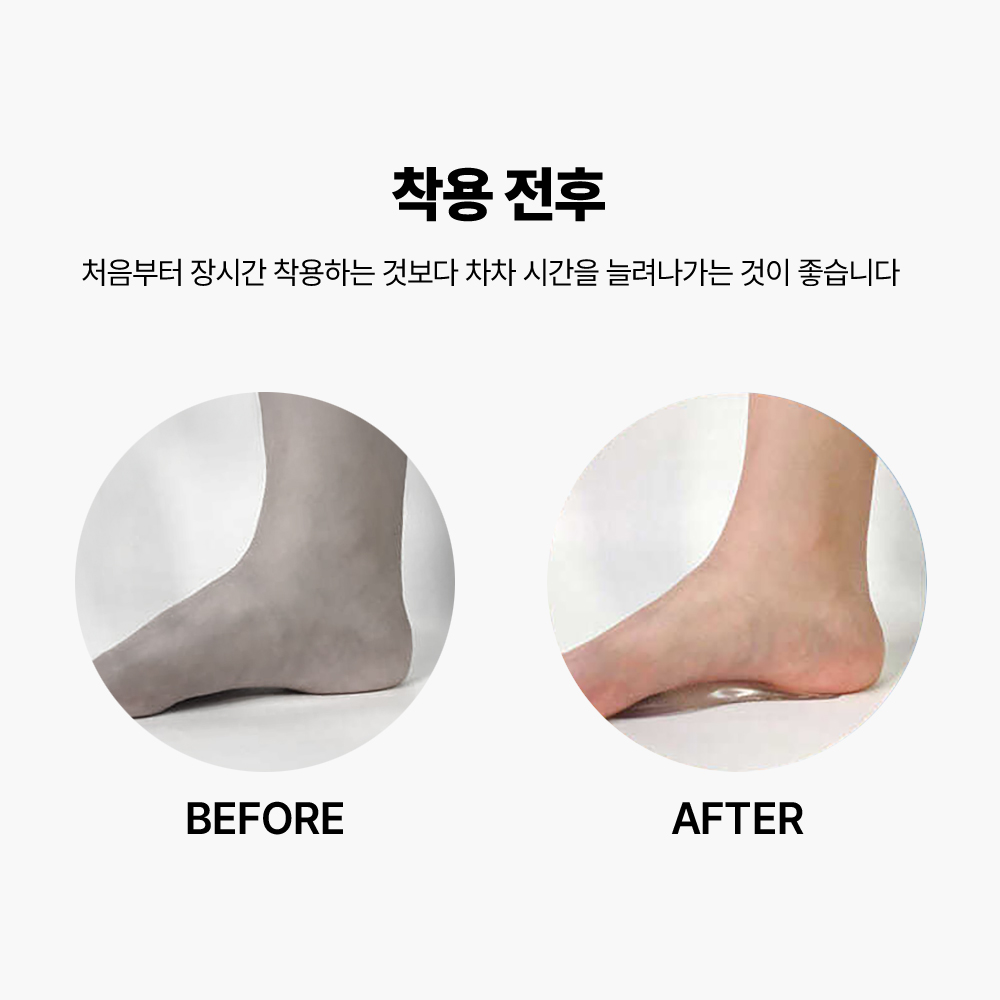 1+1 평발 통증패드 실리콘 아치 교정 전족부 구두 반깔창 - 상세 이미지 3