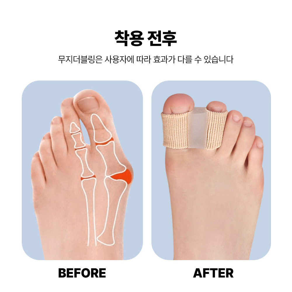 1+1 포풋 엄지 발가락 교정 보호 휴대 스트레칭 밴드 무지더블링 - 상세 이미지 3