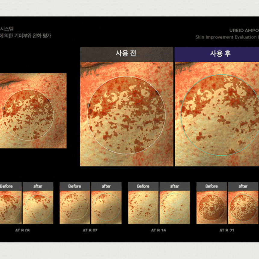 비에논 우레이드 기미앰플 검버섯 흑자 나이아신아마이드 미백앰플 사진 5