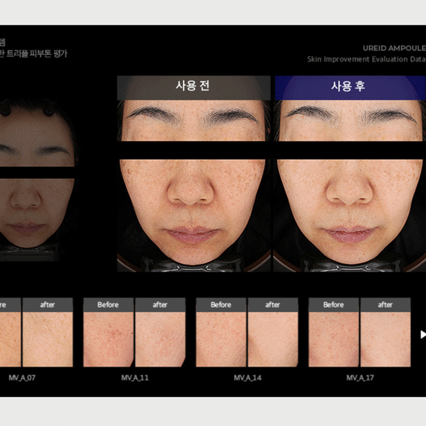 비에논 우레이드 기미앰플 검버섯 흑자 나이아신아마이드 미백앰플 사진 2