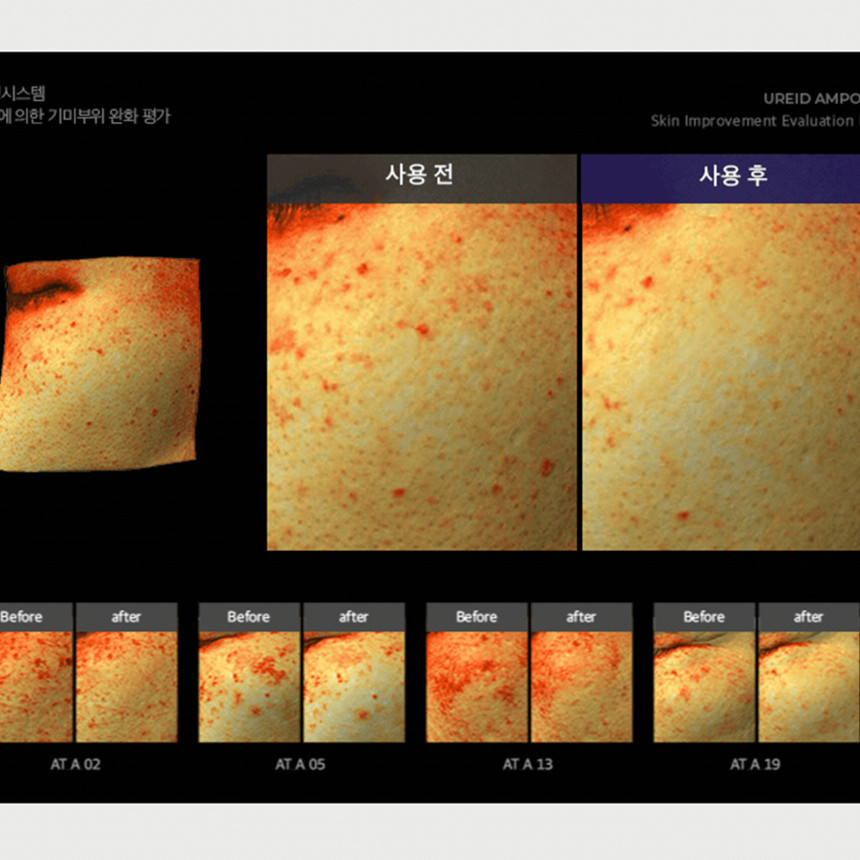 비에논 우레이드 기미앰플 검버섯 흑자 나이아신아마이드 미백앰플 사진 4