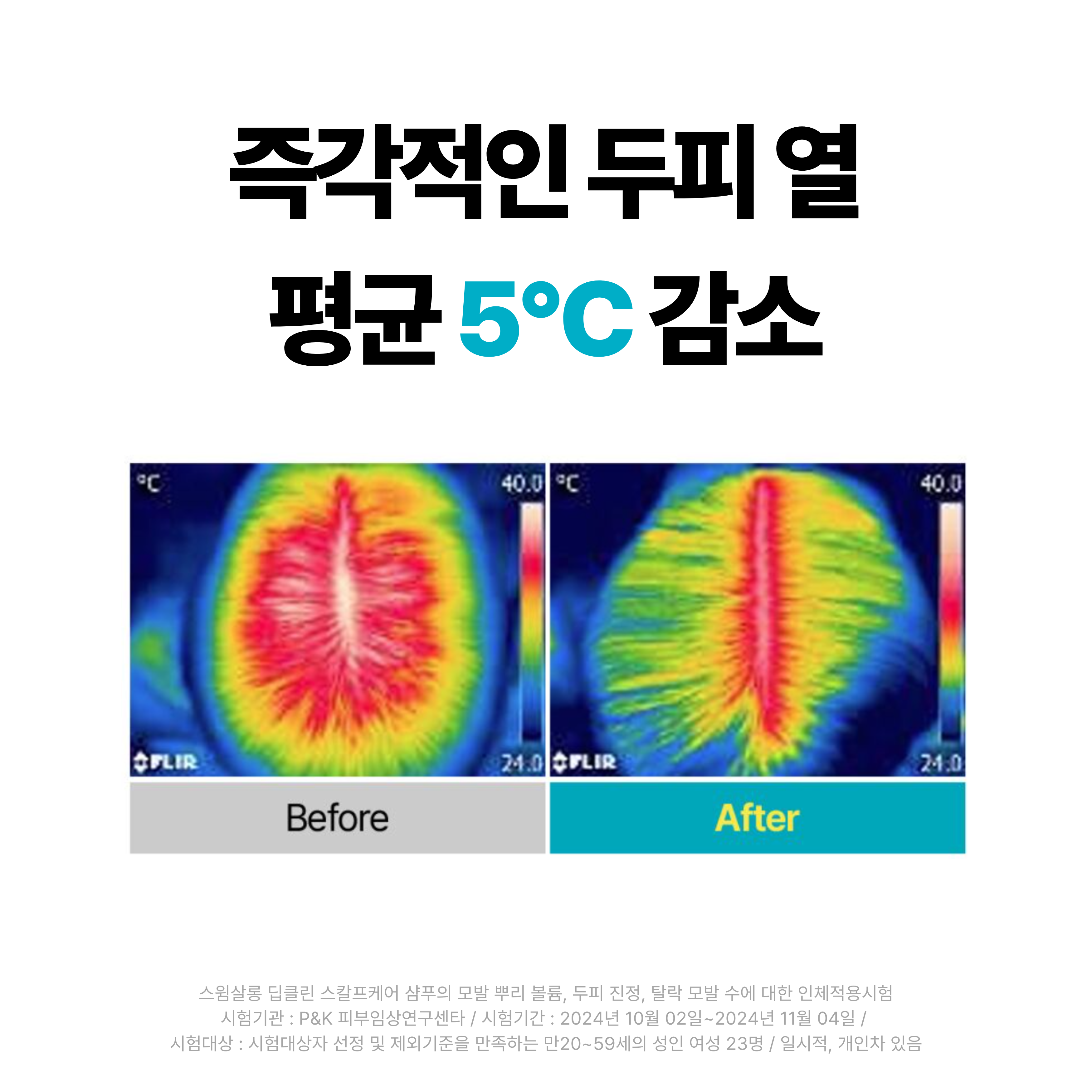 스윔살롱 샴푸&바디워시 2종 세트 수영장 염소제거 탈모완화 두피케어 저자극 약산성 이미지 7