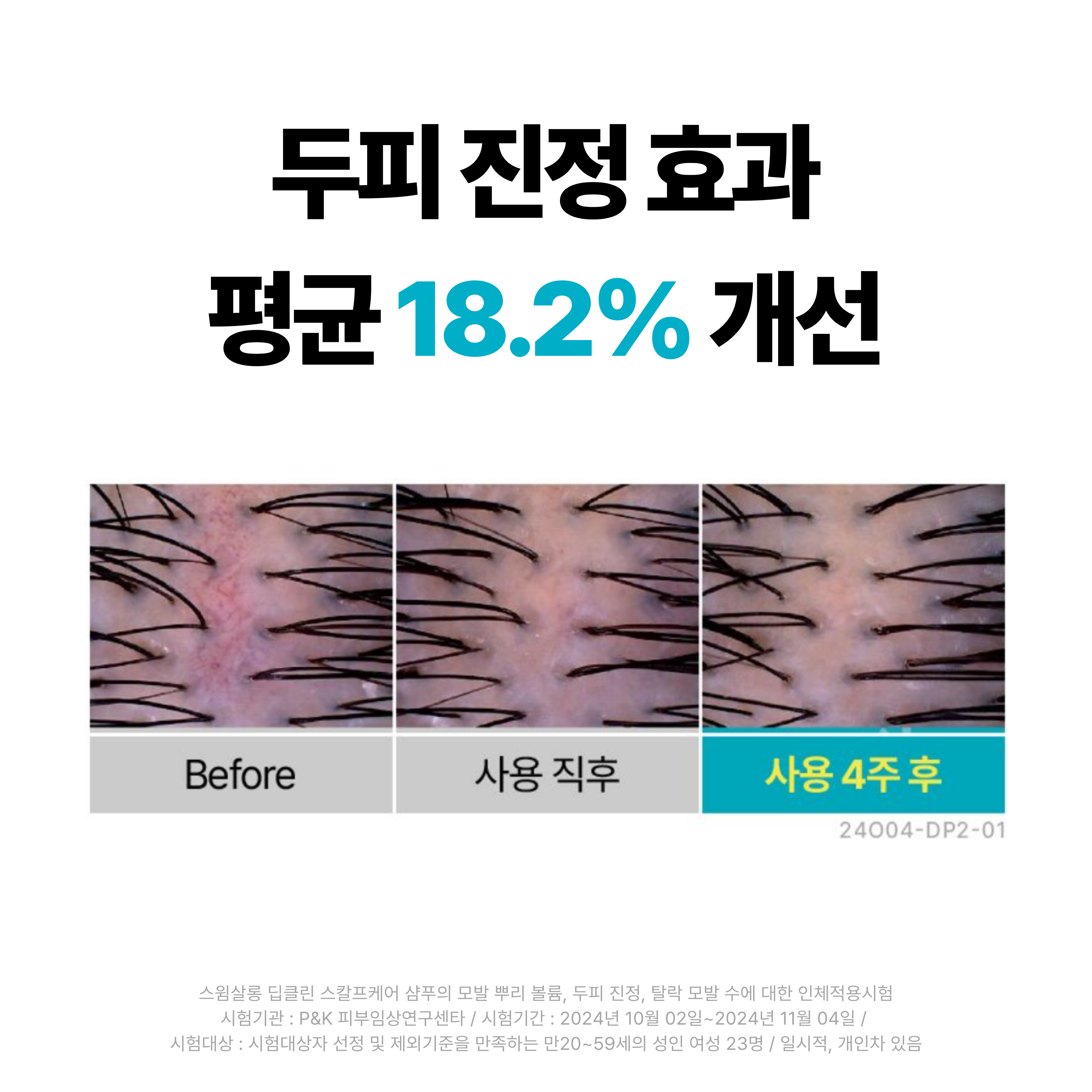 스윔살롱 수영장 샴푸 염소제거 탈모완화 저자극 수영샴푸 두피쿨링 시트러스, 300g, 1개 이미지 7