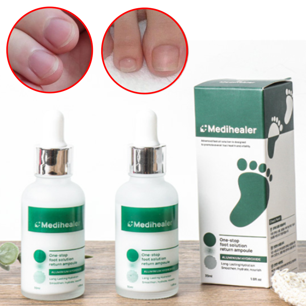 박대표마켓 손발톱영양제 30ml 문제성 손톱 발톱 네일세럼 보호제 갈라짐 손상관리 - 상품 이미지