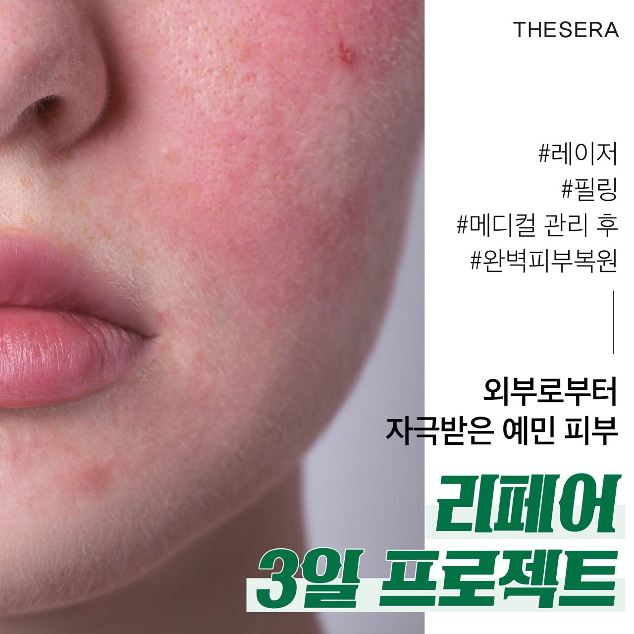 더쎄라 하이드레이팅 리페어 블레미쉬 밤 30ml 필터링 시술후 회복 BB크림 - 상세 이미지 5
