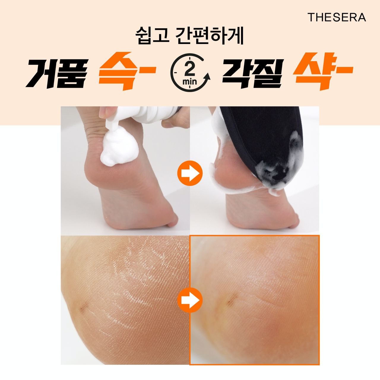 더쎄라 각질이별키트 에피더미스 발란스 폼 2개 피지관리 스크럽타월 포함 - 상세 이미지 5