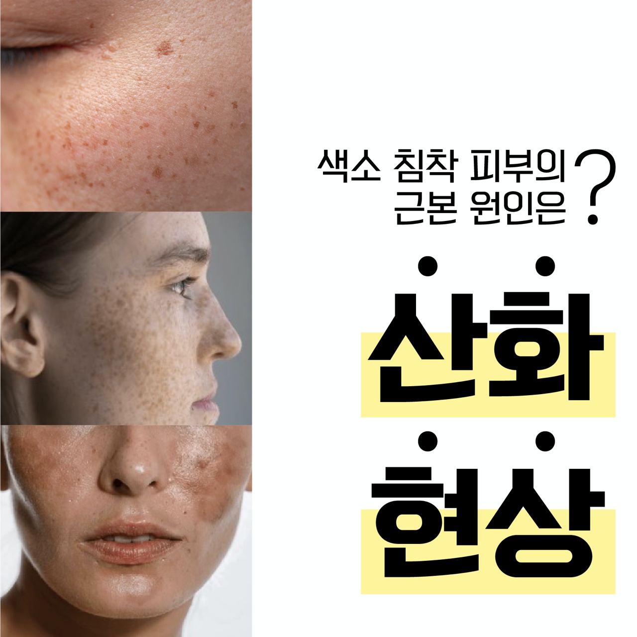 더쎄라 비타솔루션 멀티 액티브 프로 멜라터치온 리뉴얼 버전 글루타치온 비타민섭취 미백관리 - 상세 이미지 3