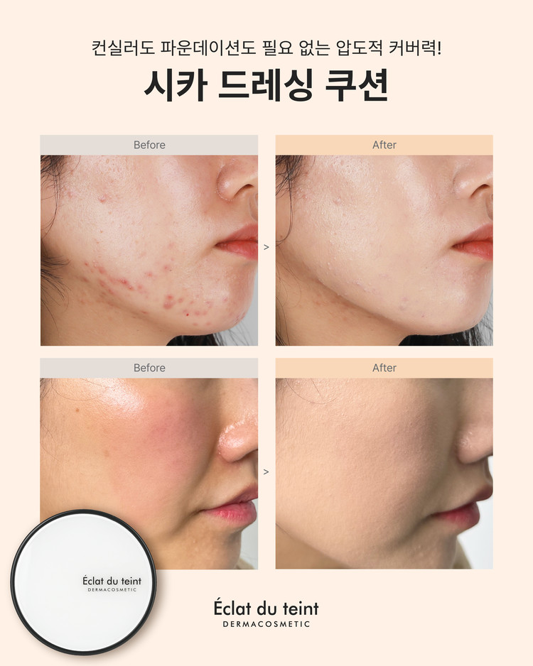 에끌라뒤땅 시카드레싱 쿠션 본품+리필 민감 붉은피부 트러블자국 커버 - 상세 이미지 2